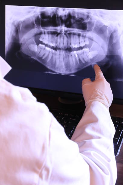 Best Emergency Wisdom Teeth Removal in New Town, ND
