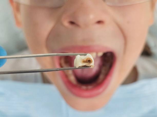 Best Same-Day Emergency Dental Services in New Town, ND