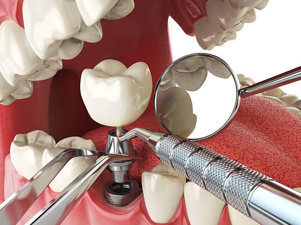 Best Emergency Treatment for Dental Infections or Abscesses in New Town, ND